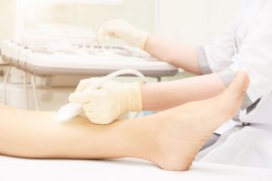Procedimentos - Hospital AngioVascular
